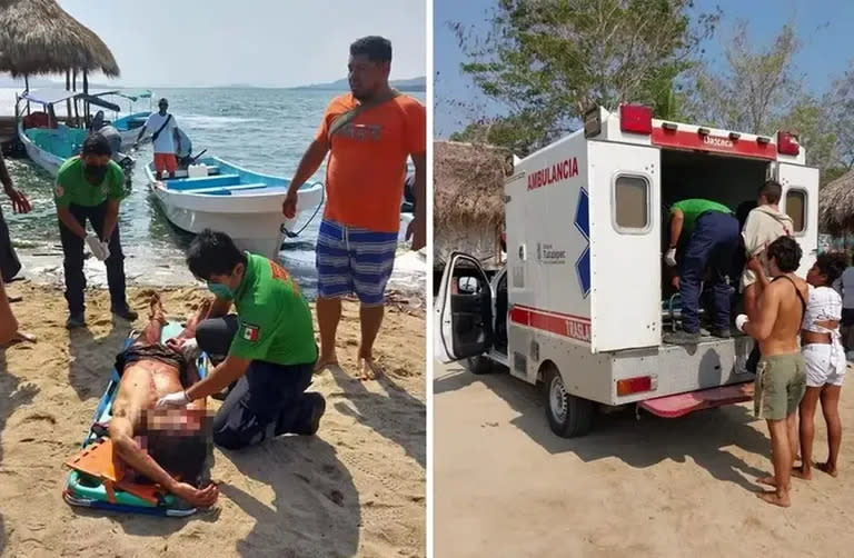 Benjamín recibió tres machetazos en la cabeza, mientras que Santiago sufrió una fractura en su mano