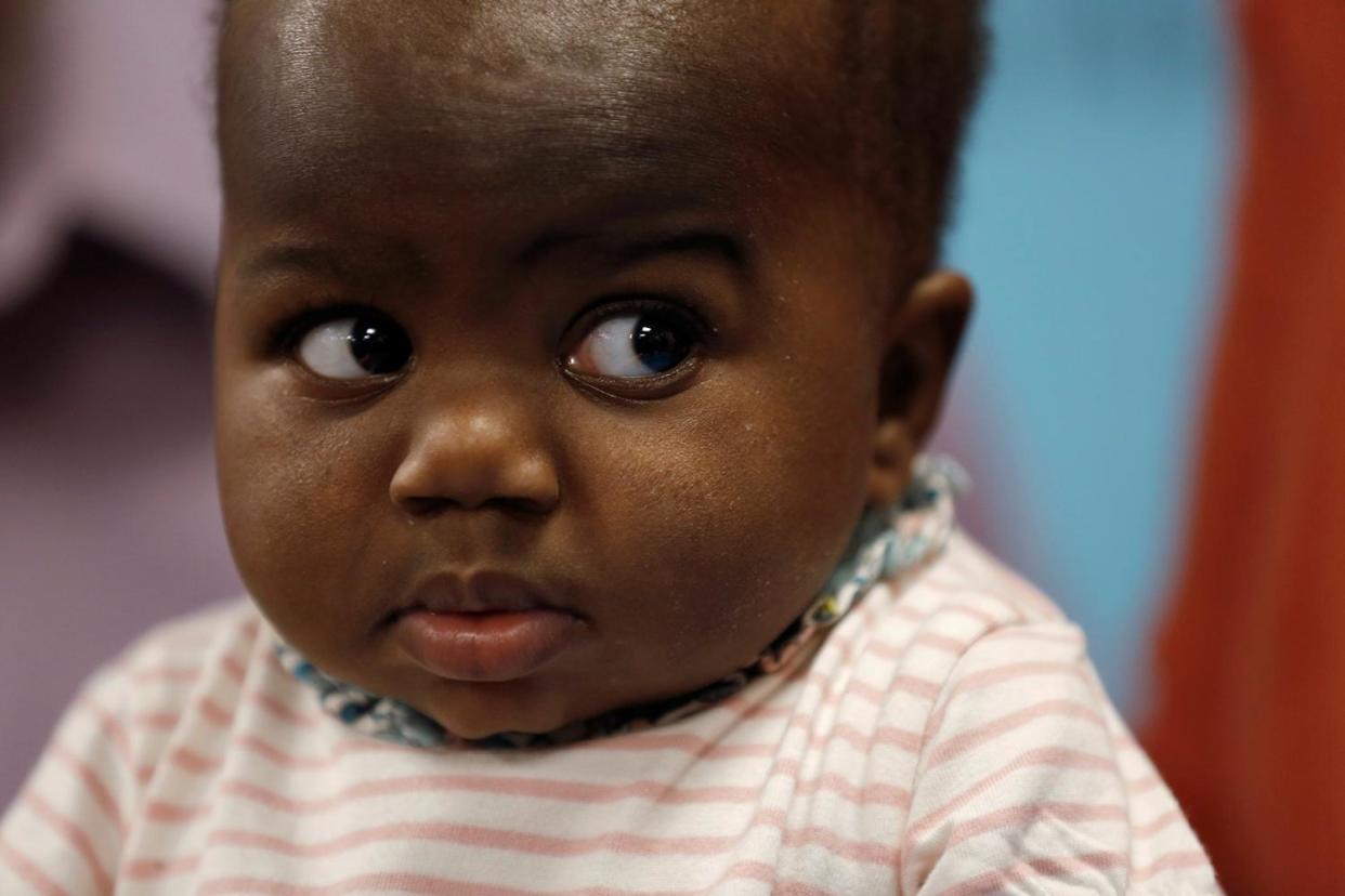 Complex surgery: Baby Dominique following her operation: REUTERS