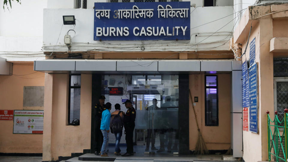 The burns unit where the woman was treated.