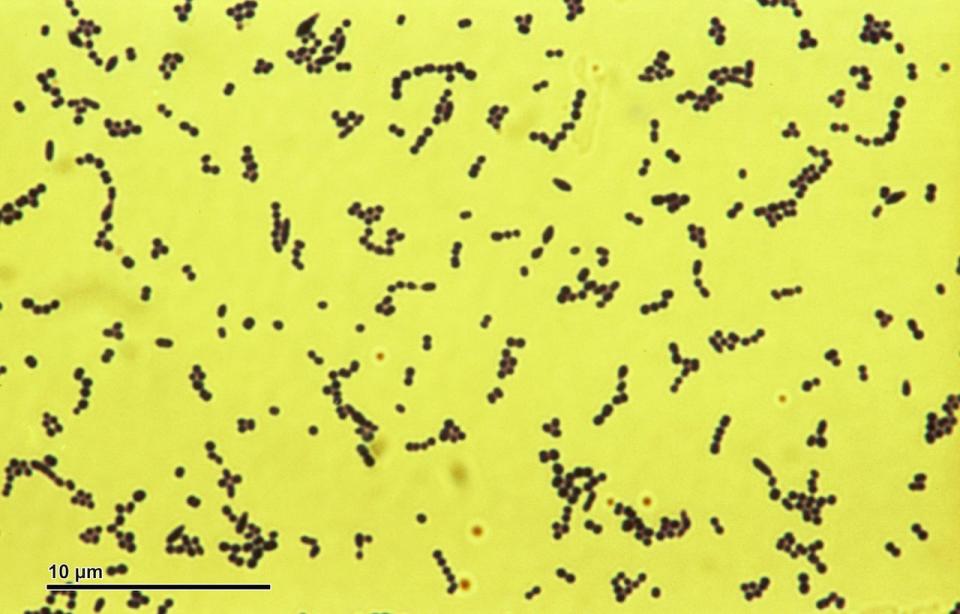 A microscopic view of Streptococcus bacteria, which can cause a spectrum of disease, ranging from milder infections like strep throat to life-threatening illness.