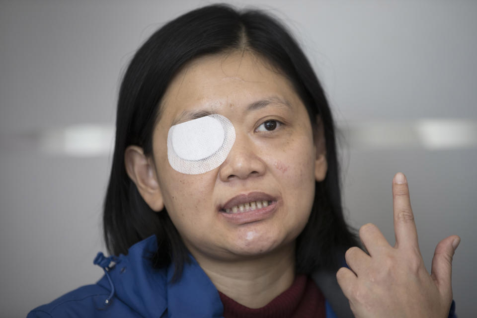 In this Wednesday, Dec. 4, 2019, photo, Veby Mega Indah, an injured Indonesian video journalist, speaks during an interview with The Associated Press in the Wan Chai area of Hong Kong. More than two months after being blinded in one eye by what she believes was a projectile fired by riot police, Indah is still seeking answers. On Sept. 29, 2019, Indah was among a group of reporters covering one of the hundreds of clashes between armed police and anti-government protesters that have broken out almost daily over the past six months. (AP Photo/Vincent Thian)