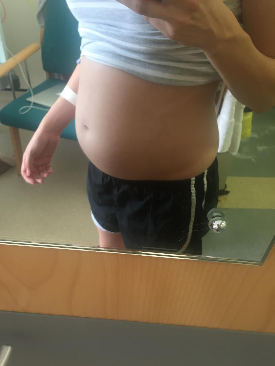 Sarah could not understand why she was putting on weight and a gym instructor thought she might be pregnant (SWNS)