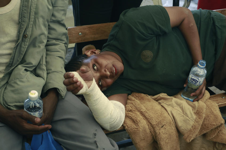 Residents who suffered burns following a fire caused by a vehicle loaded with gas which exploded, get treatment at Mama Lucy Hospital in Nairobi, Kenya, Friday, Feb. 2, 2024. The truck explosion ignited a huge fireball, and a flying gas cylinder set off a fire that burned down the Oriental Godown, a warehouse that deals with garments and textiles, according to government spokesman Isaac Mwaura. (AP Photo)