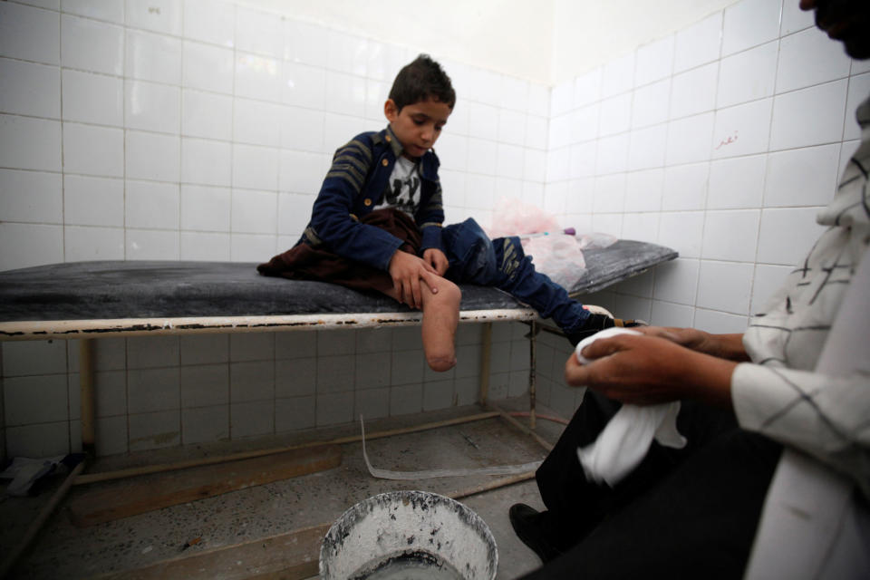 A boy sits in a prosthetic limbs center in Sanaa, Yemen