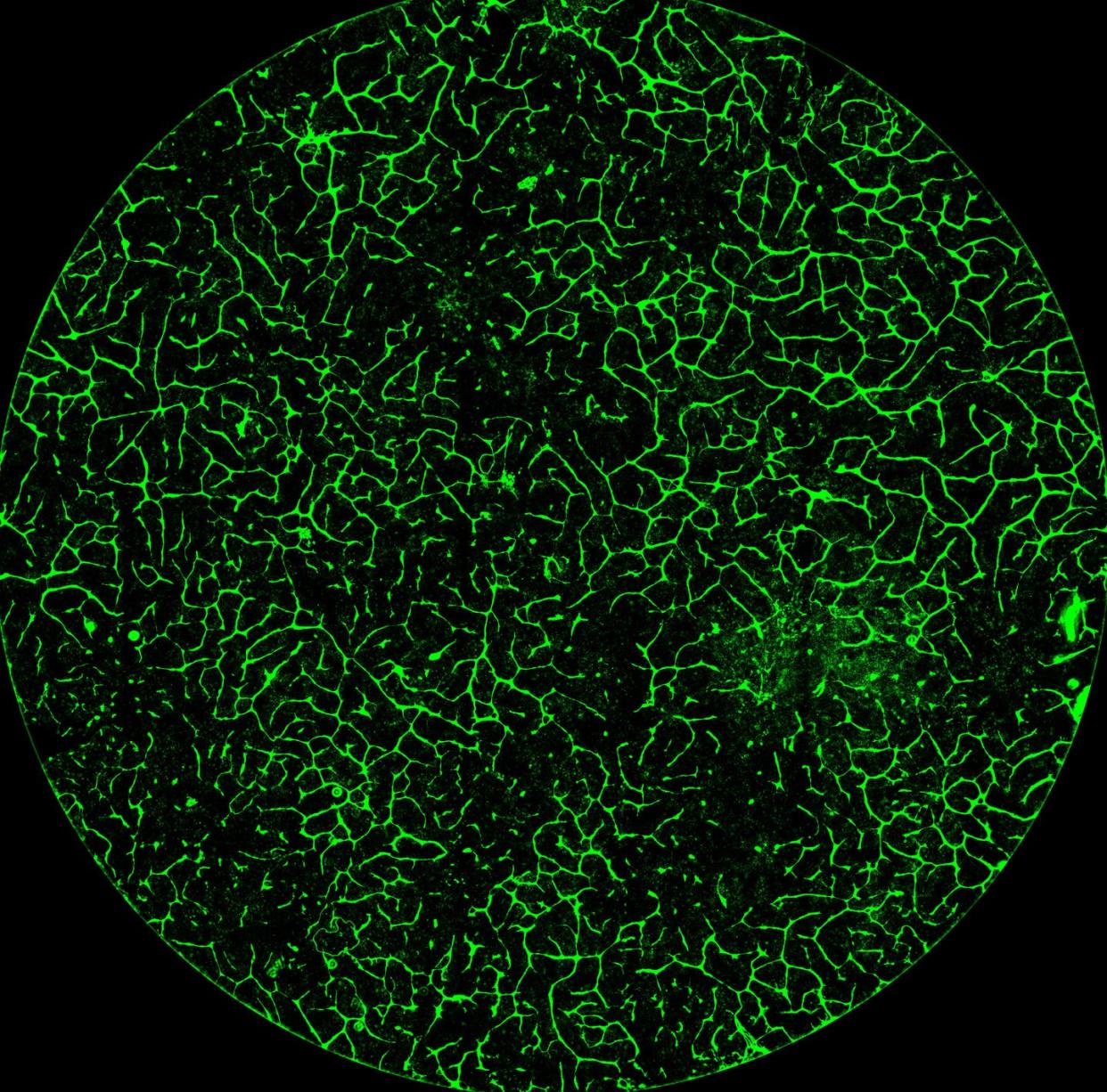 <span class="caption">A cross section of lab-grown human liver tissue. The green shows the network of blood vessels.</span> <span class="attribution"><span class="source">Velazquez et al. Cell Systems </span>, <a class="link " href="http://creativecommons.org/licenses/by-sa/4.0/" rel="nofollow noopener" target="_blank" data-ylk="slk:CC BY-SA;elm:context_link;itc:0;sec:content-canvas">CC BY-SA</a></span>