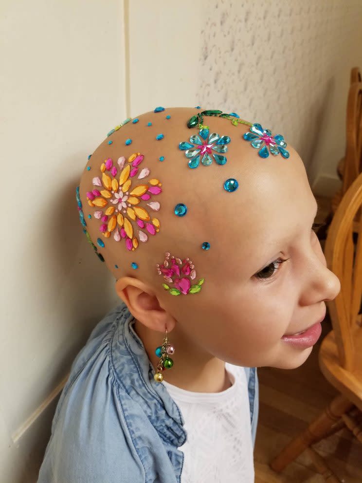 Gianessa Wride, 7, has alopecia, an autoimmune disease that causes hair loss.