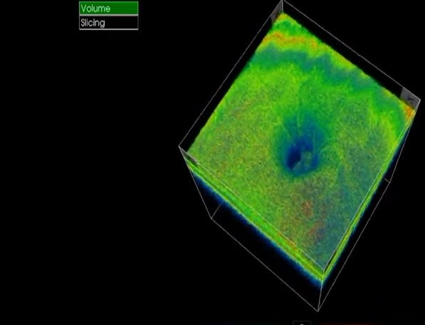 Tomografía de Coherencia Óptica es utilizada generalmente para estudios del ojo / Foto: oftalmologia-avanzada.com