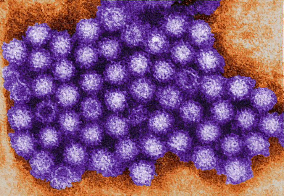 Image: Norovirus (Charles D. Humphrey / CDC)