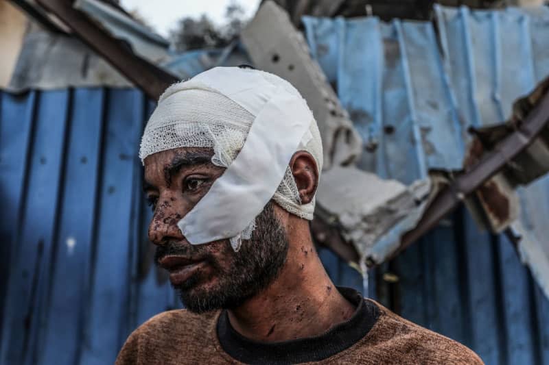 The Palestinian Ahmed Al-Sufi with a bandaged head looks on in the aftermath of an Israeli air strike, amid the ongoing conflict between Israel and the Palestinian militant group Hamas. Abed Rahim Khatib/dpa