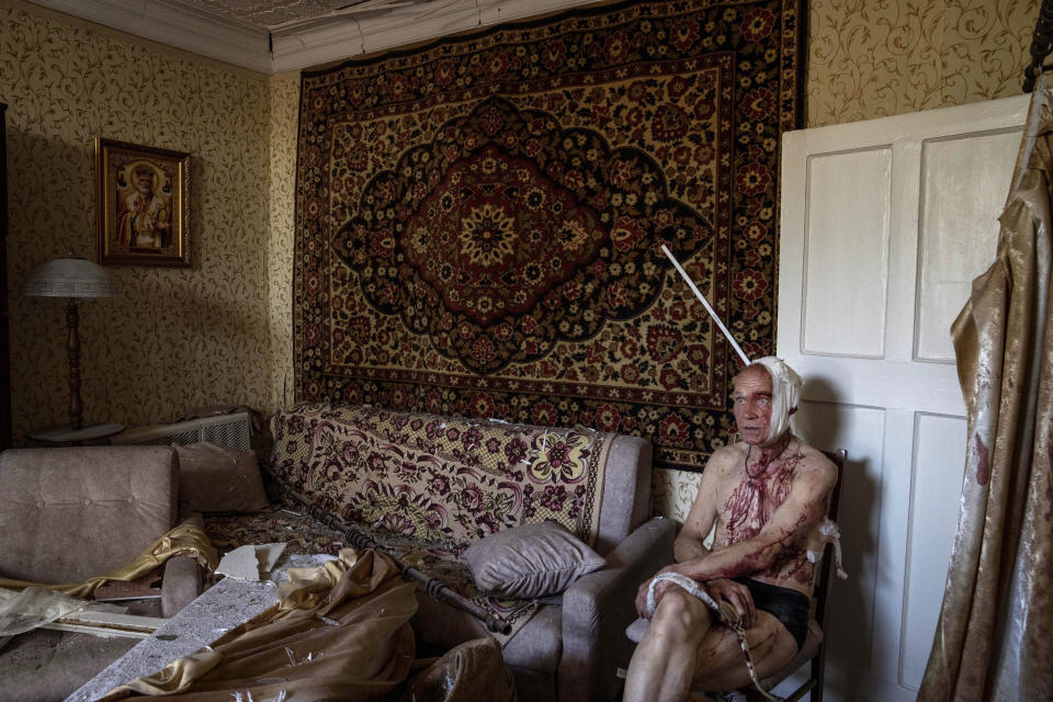 Volodymyr, de 66 años, lesionado por un ataque, se sienta en una silla en su departamento el jueves 7 de julio de 2022 en Kramatorsk, región de Donetsk, en el este de Ucrania. (AP Foto/Nariman El-Mofty)