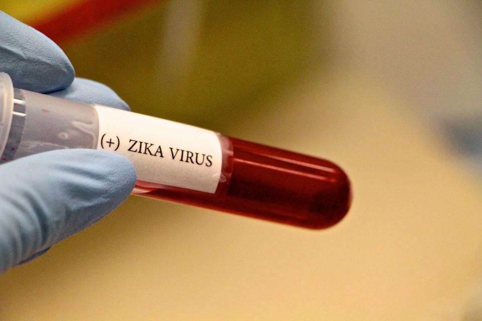 Close-Up Of Hand Holding Blood Sample For Zika Virus Test