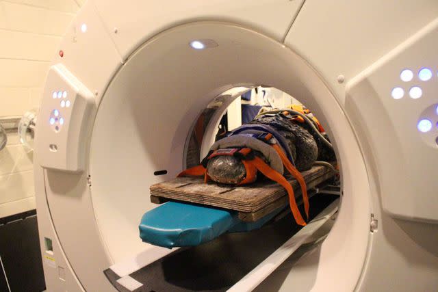 <p>Sarah Carey</p> Brooke positioned in the CT scanner for imaging of his head.