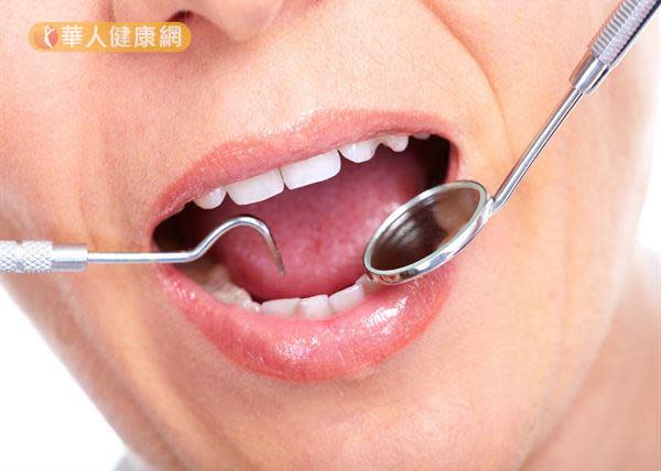 何時可做牙齒自體移植？一次就看懂！