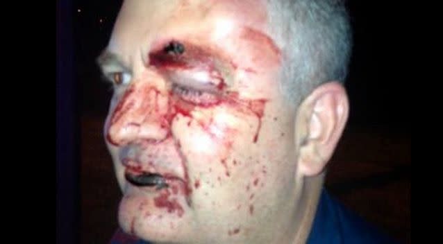 Brad Johnson was brutally beaten by a patient in the back of an ambulance. Photo: Supplied