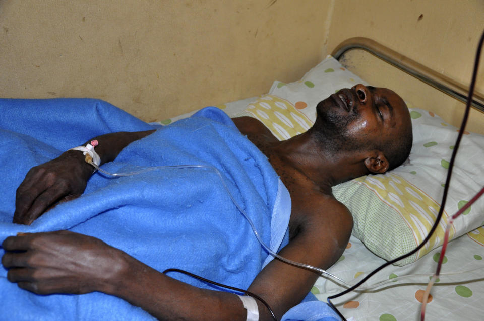 A wounded man lies in a hospital bed at the Nyanya general hospital following a blast at a bus park in Abuja, Nigeria, Monday, April 14, 2014. Police say an explosion that ripped through a busy bus station in Nigeria's capital has killed and injured scores of people. (AP Photo/Gbemiga Olamikan)