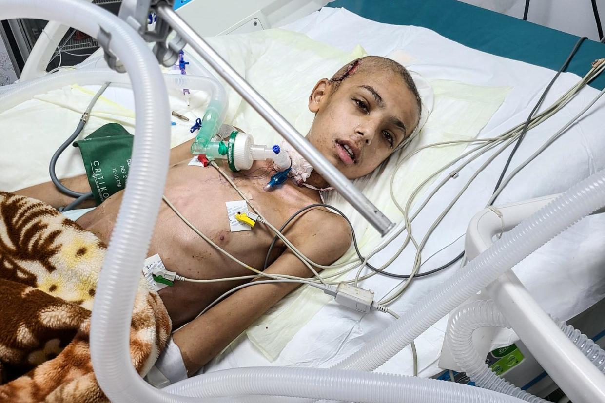 <span>A child hospitalized with a gunshot wound at the European public hospital near Rafah, Gaza, in February 2024.</span><span>Photograph: Courtesy of Dr Fozia Alvi</span>