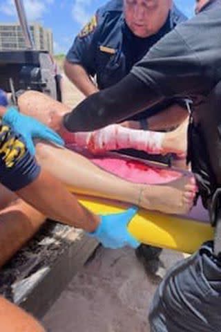 <p>United States Border Patrol's Laredo Sector.</p> One of the shark attack victims receiving treatment