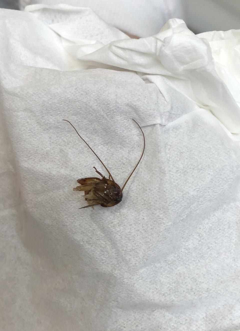 La ominosa cabeza de la cucaracha que Katie Holley tuvo por nueve días dentro de su oído izquierdo. (Katie Holley via AP)