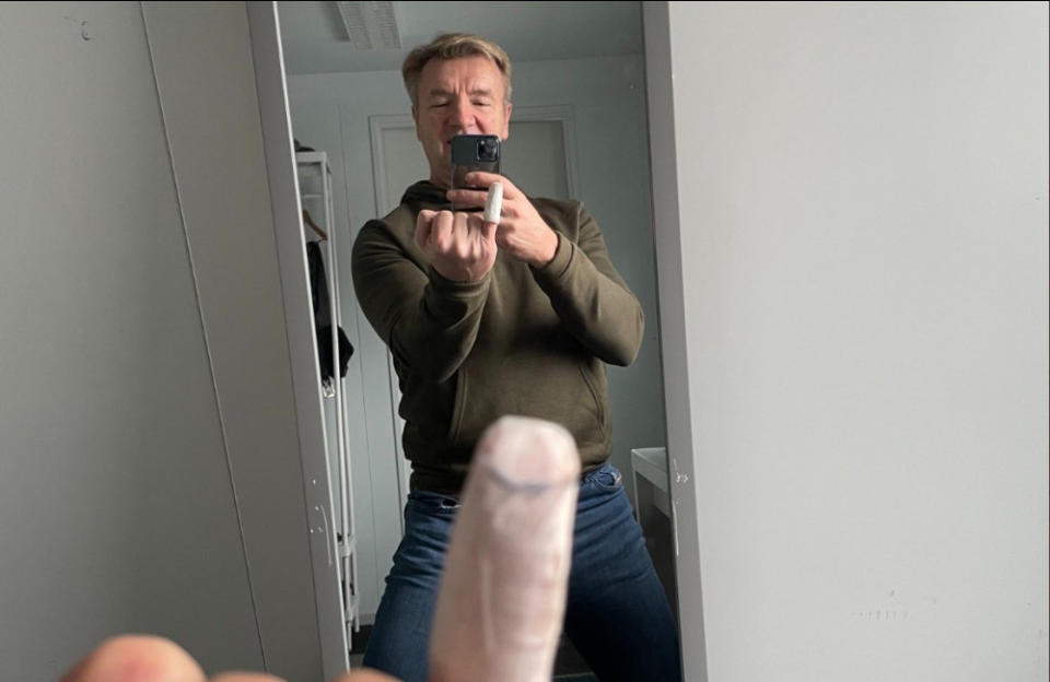 Christopher Dean broke his finger credit:Bang Showbiz