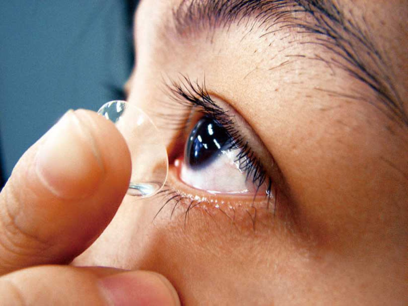 長時間配戴隱形眼鏡、瞳孔變色片，容易降低角膜敏感度，加上鏡片水分蒸發後會吸收淚液，導致淚液分泌不足，增加罹患乾眼症機率。（圖／報系資料庫）