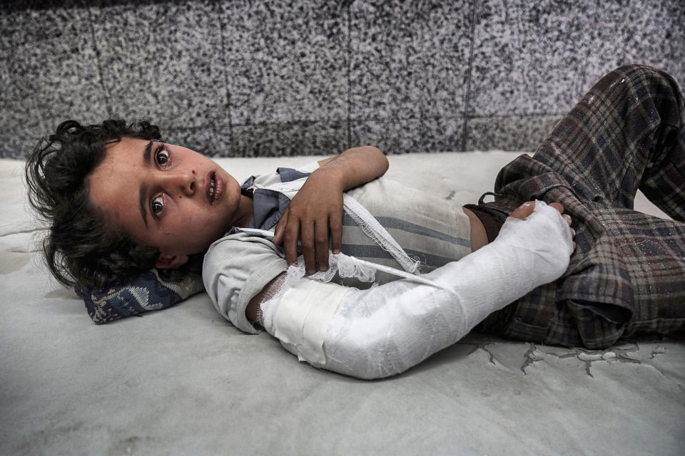 Injured boy in Sana’a