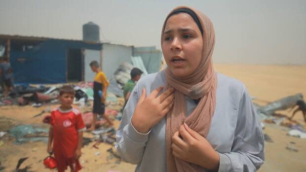 Malak Filfel, 23, survived the airstrike that started a fire at a tent camp in Rafah, in the southern Gaza Strip, on May 26. The deadly strike on an area that had previously been declared a safe zone resulted in global condemnation. 