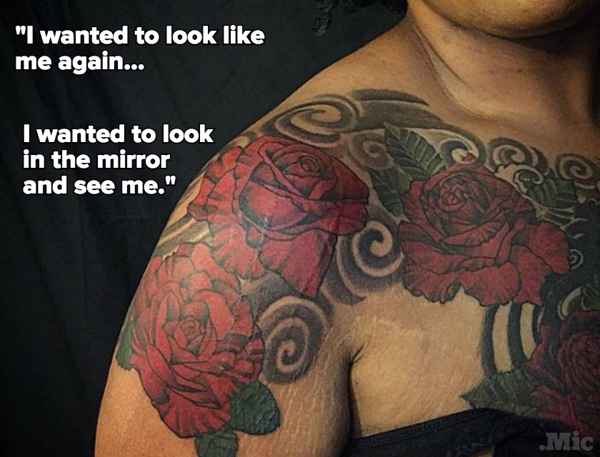These Women Are Taking Ownership of Their Scars With Beautiful Tattoos