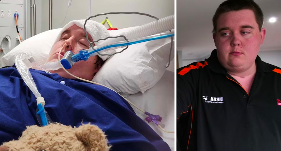 Albury man Dylan Meyer in hospital and now. 