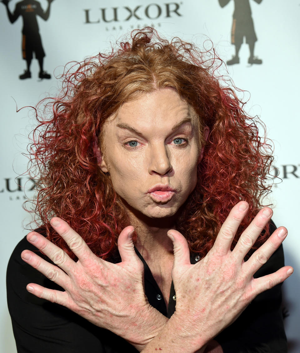 A closeup of Carrot Top