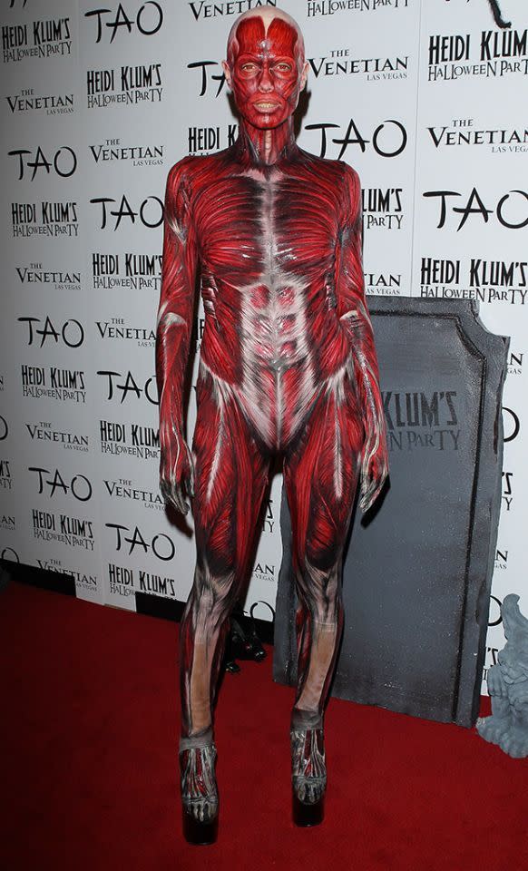 <p>No. 2: At her first party in 2011 (she had two that year), Klum arrived in an anatomy-inspired ensemble with a hand-painted bodysuit displaying bones, muscles, veins, and tendons. The look, which took three and a half hours to put together, also included gross yellow prosthetic teeth and red contact lenses. Making it a little playful? Gigantic platform shoes. The best part, however, was that she arrived on a stretcher. Two blood-covered doctors wheeled her down the red carpet and into the bash. Bloody perfect! (Photo: Getty Images) </p>