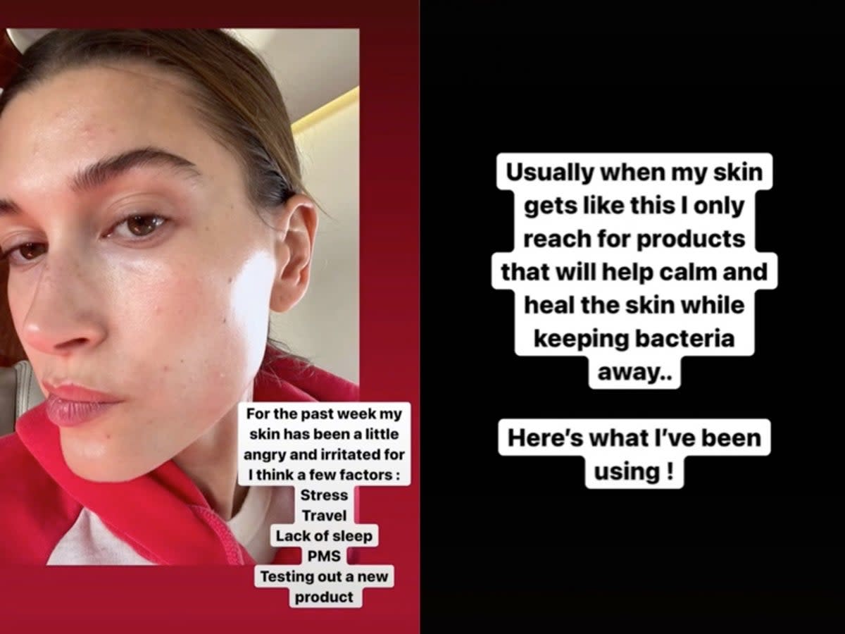  (TikTok / Hailey Bieber)