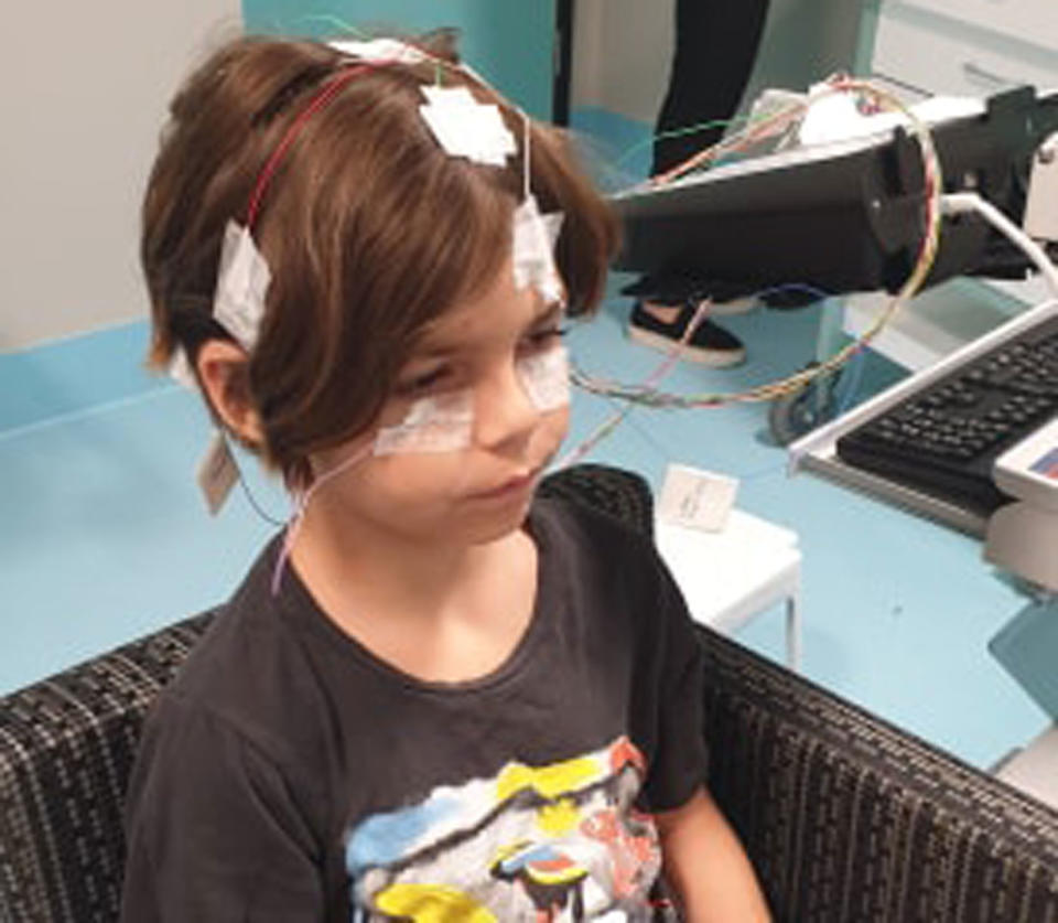 Theo Thomas, 8, is pictured with wiring and patches around his head. His mum says he will suffer permanent retinal damage.