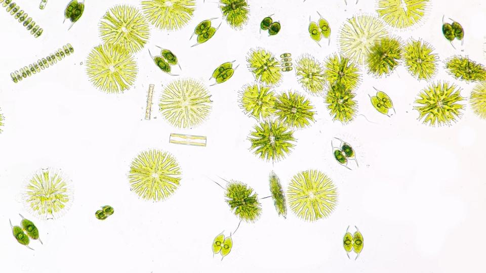 lime green-coloured microorganisms on a white background