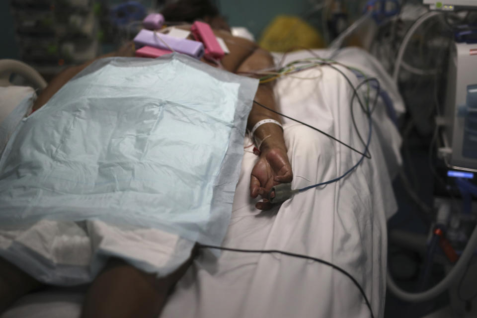 A patient affected with COVID-19 lies on a bed in a Marseille hospital, southern France, Thursday, Sept.10, 2020. As the Marseille region has become France's latest virus hotspot, hospitals are re-activating emergency measures in place when the pandemic first hit to ensure they're able to handle growing new cases. (AP Photo/Daniel Cole)