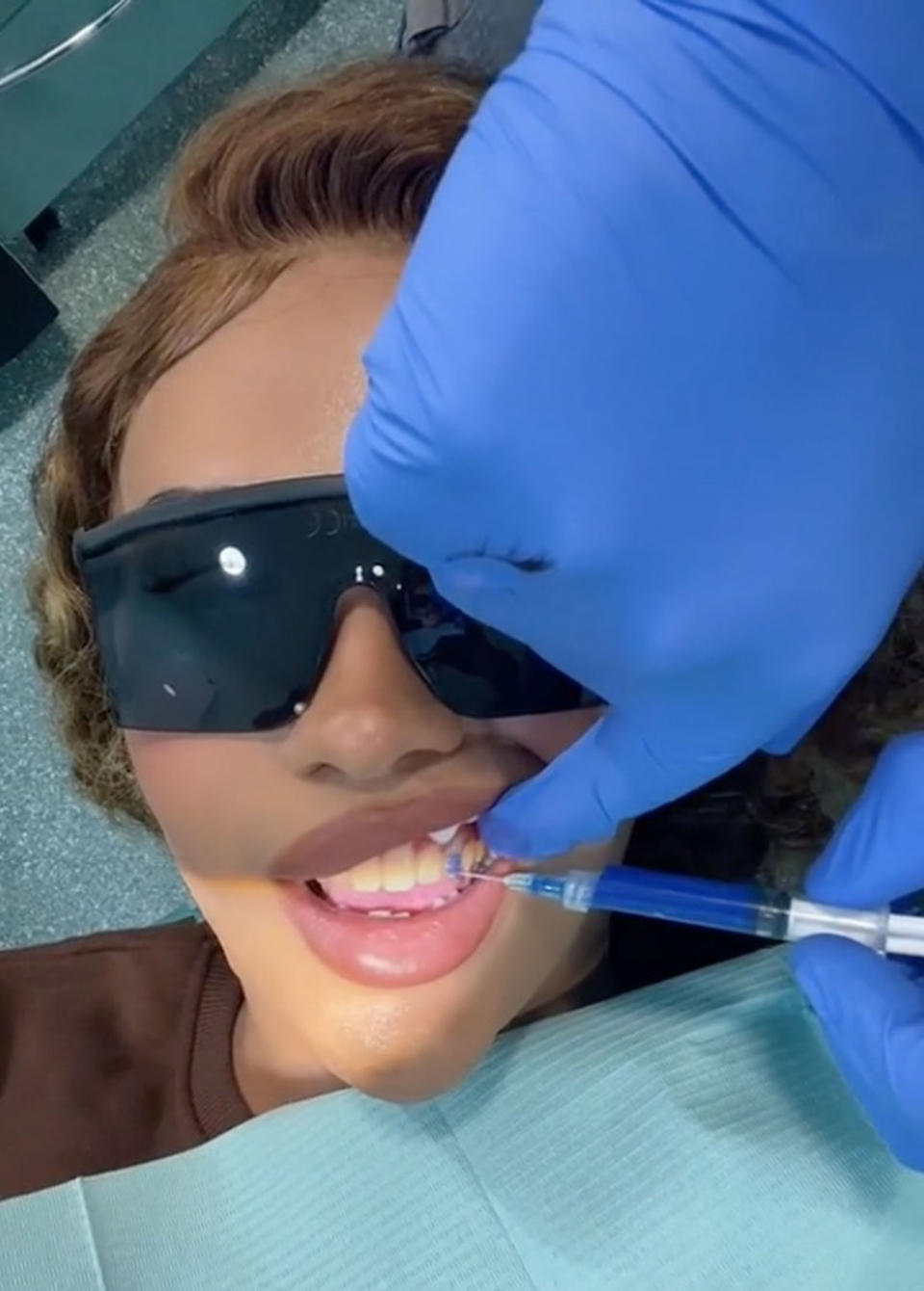 Cassie during her fang surgery. (Getty Images)