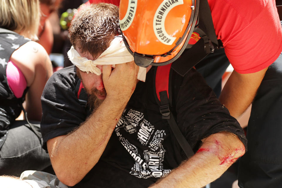 <p>Rescue workers and medics tend to many people who were injured when a car plowed through a crowd of anti-facist counter-demonstrators marching through the downtown shopping district Aug. 12, 2017 in Charlottesville, Va. (Photo: Chip Somodevilla/Getty Images) </p>