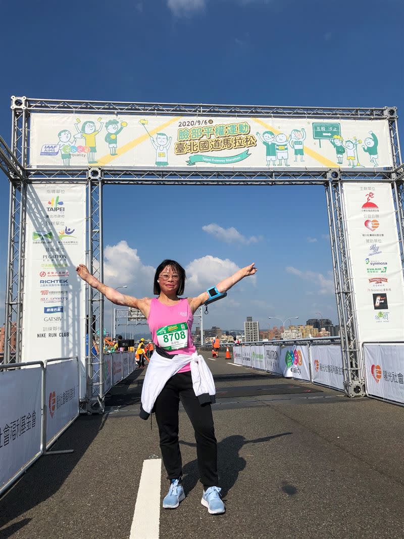 吳承怡上國道為臉部平權而跑，完賽10K。（圖／陽光基金會提供）