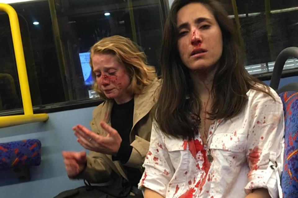 One of two women who were violently attacked on a London night bus by a group of young men who demanded the couple kiss, has said she is sick of being asked to perform by men who treat women like “sexual objects”.Melania Geymonat, a 28-year-old doctor from Uruguay who is training to become a surgeon, was on a date with her girlfriend Chris, a 29-year-old American, when the attack took place when the pair were surrounded by a group of five men in the early hours of 30 May, when they were followed by the group of five men.“We climbed upstairs and took the front seats,” Dr Geymonat said in a Facebook post. “We must have kissed or something because these guys came after us. I don’t remember if they were already there or if they got on after us.”A photograph of the couple’s bloodied faces immediately after they were punched by the men has raised awareness of the level of homophobic abuse gay people are still subjected to.Dr Geymonat has had surgery to reset bones in her nose, and Chris suffered a fractured jaw.After the men hit them, they robbed them of a smartphone and a wallet.“In the first place they came towards us because we were seen as sexual objects," Dr Geymonat told The Times. “It’s not the first time this happens to me that I’m with a girlfriend or on a date and men tend to be excited by watching. That’s one of the things that really annoyed me. I’m 28 so it has been 10 years that I’ve seen this. We are not performing."She added that it felt "really humiliating" to be treated that way. Discussing the role of pornogrpahy in how men view women, Dr Geymonat said: “I do think that, of course, porn plays its own part in contributing, in treating women as objects that are there for the male gaze.”She said every woman has experienced the sudden anxiety in certain situations when “you see one man, and you have to cross the street, you have to hide your phone, you have to take care of yourself. And that’s everywhere.”Dr Geymonat’s original Facebook post including the photograph of the pair just after the attack has been shared more than 15,000 times.Five males aged between 15 and 18-years-old were arrested in relation to the incident.They have been charged with robbery and aggravated grievous bodily harm. All five have been bailed until July.