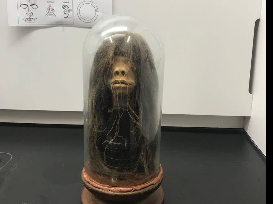 A movie prop used in a 1979 film has been proven to be a real human head after tests done at Mercer University in Georgia.  (Adam Kiefer/Mercer University)