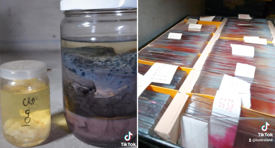 Organs in jars and blood samples in filing cabinet. 