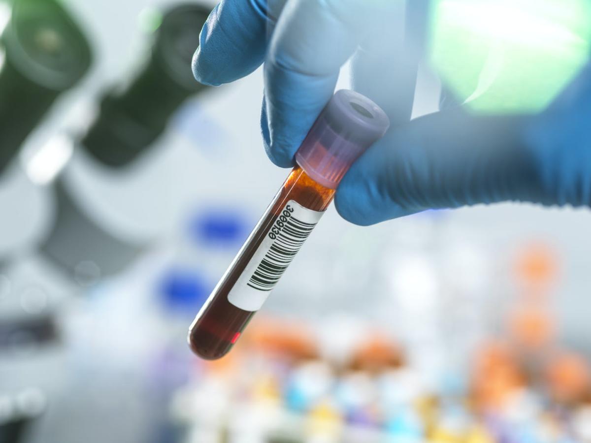 A blood test that screens for multiple cancers at once promises to ...