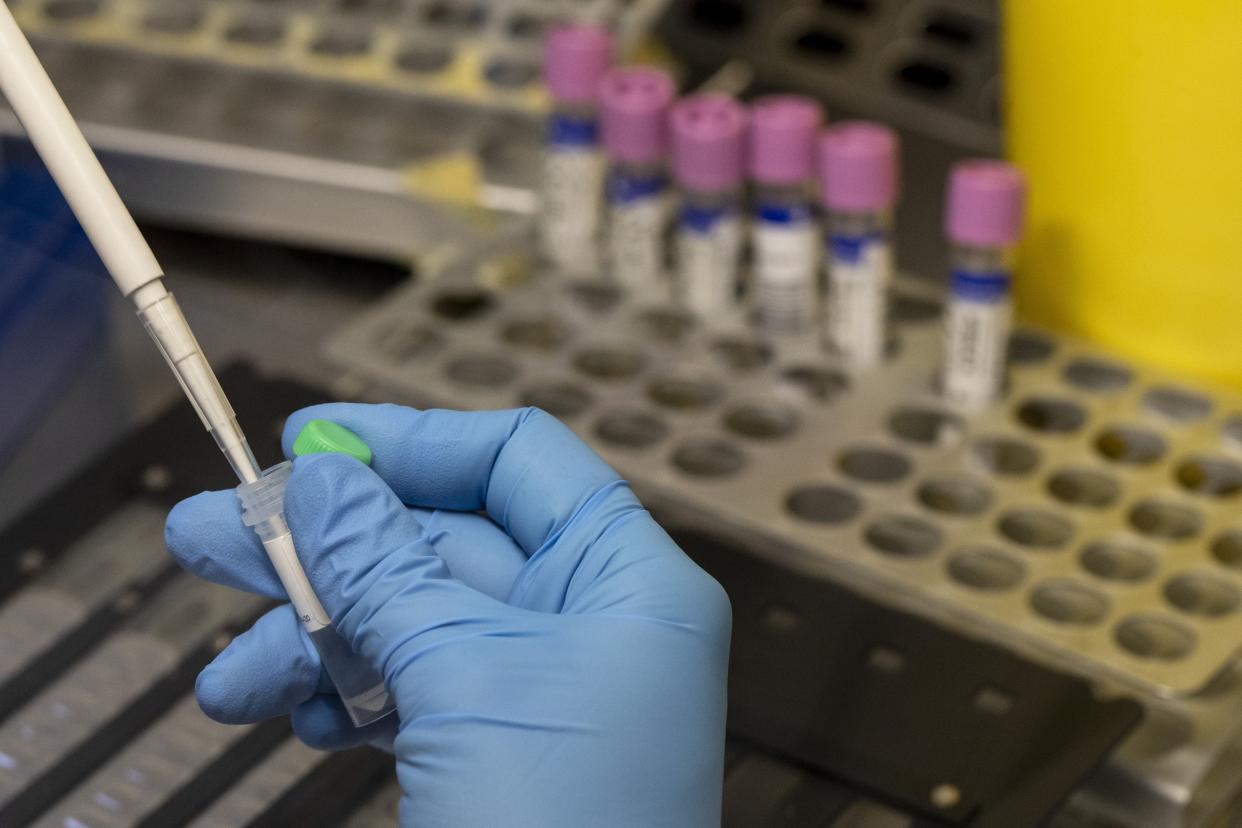 A medical laboratory technician inactivates suspected monkeypox samples to be PCR tested at the microbiology laboratory of La Paz Hospital on June 6, 2022 in Madrid, Spain. 