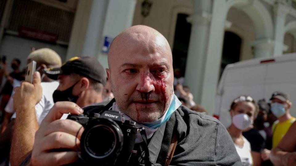 Ramón Espinosa con la cara ensangrentada