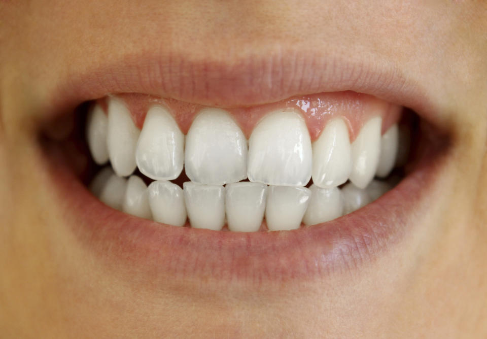 Los dientes tienen un tono amarillento natural / Foto: Thinkstock
