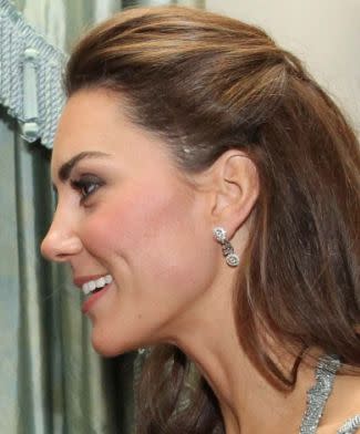 Close-up of Kate, duchess of Cambridge, and the scar that led the palace to reveal details about a childhood operation she underwent. (Getty Images)