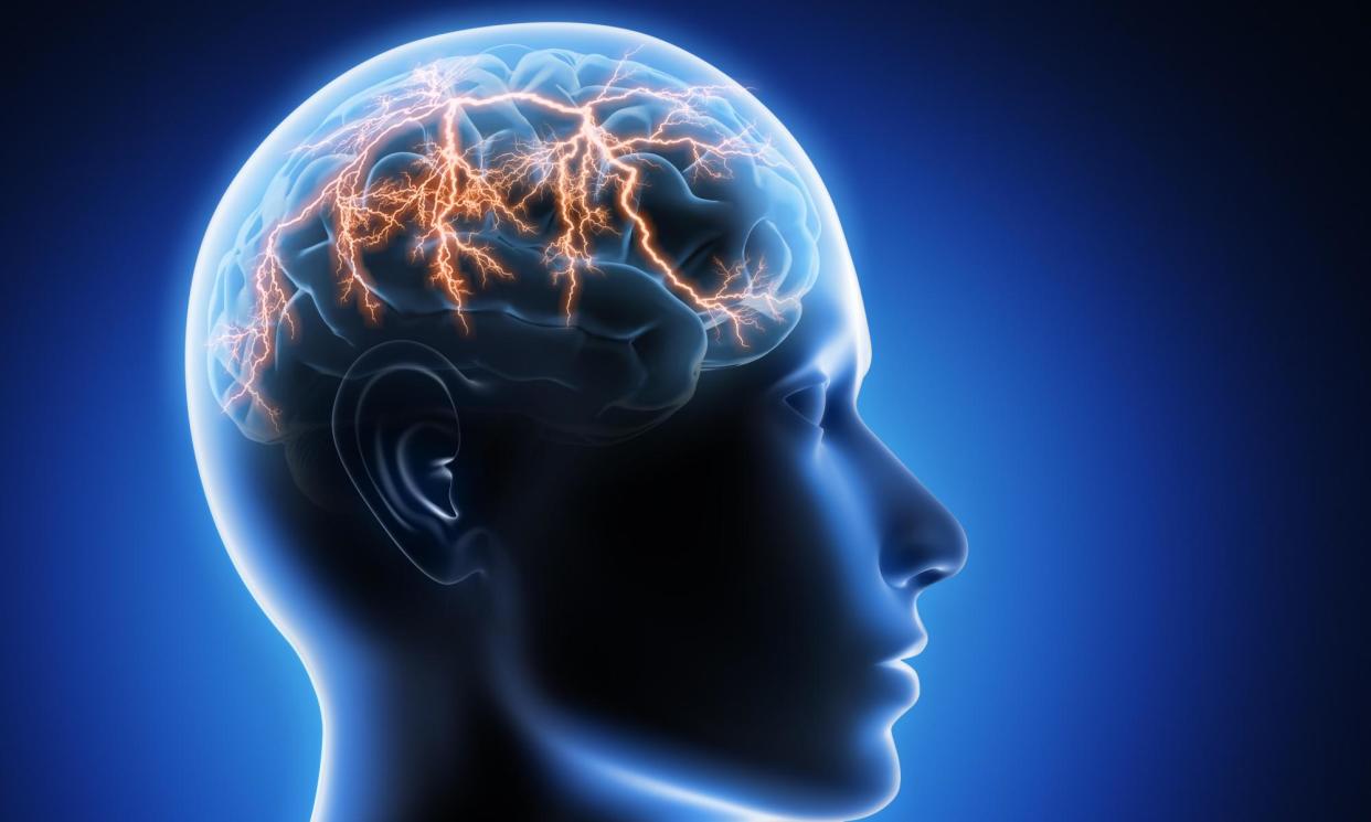 <span>Neurological conditions caused 11.1 million deaths in 2021.</span><span>Photograph: peterschreiber.media/Alamy</span>