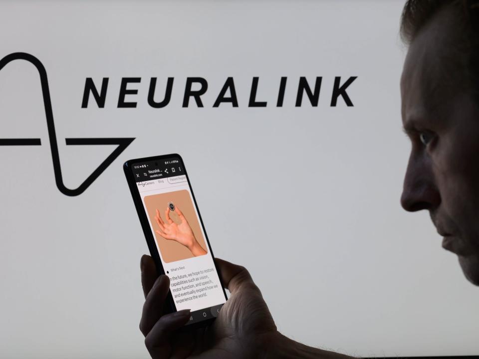 Elon Musk und Neuralink-Führungskräfte verkündeten am Mittwochnachmittag in einem Livestream, wohin sich das Unternehmen für Gehirnchips entwickelt. - Copyright: NurPhoto/Getty