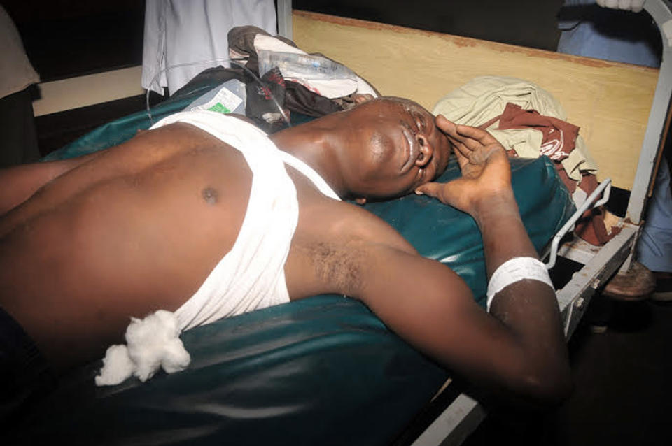 An injured man lies in hospital in Mombasa Kenya, Saturday, May, 3, 2014. At least three have been confirmed dead and several others injured in twin explosions in the coastal city of Mombasa, Kenya, police said on Saturday. Mombasa Country police commander, Robert Kitur said they have not established the cause of the explosions at Reef Hotel Nyali and Mwembe Tayari in town. (AP Photo)