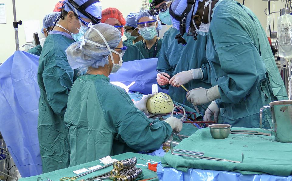 Duke surgical team preparing the artificial heart transplant