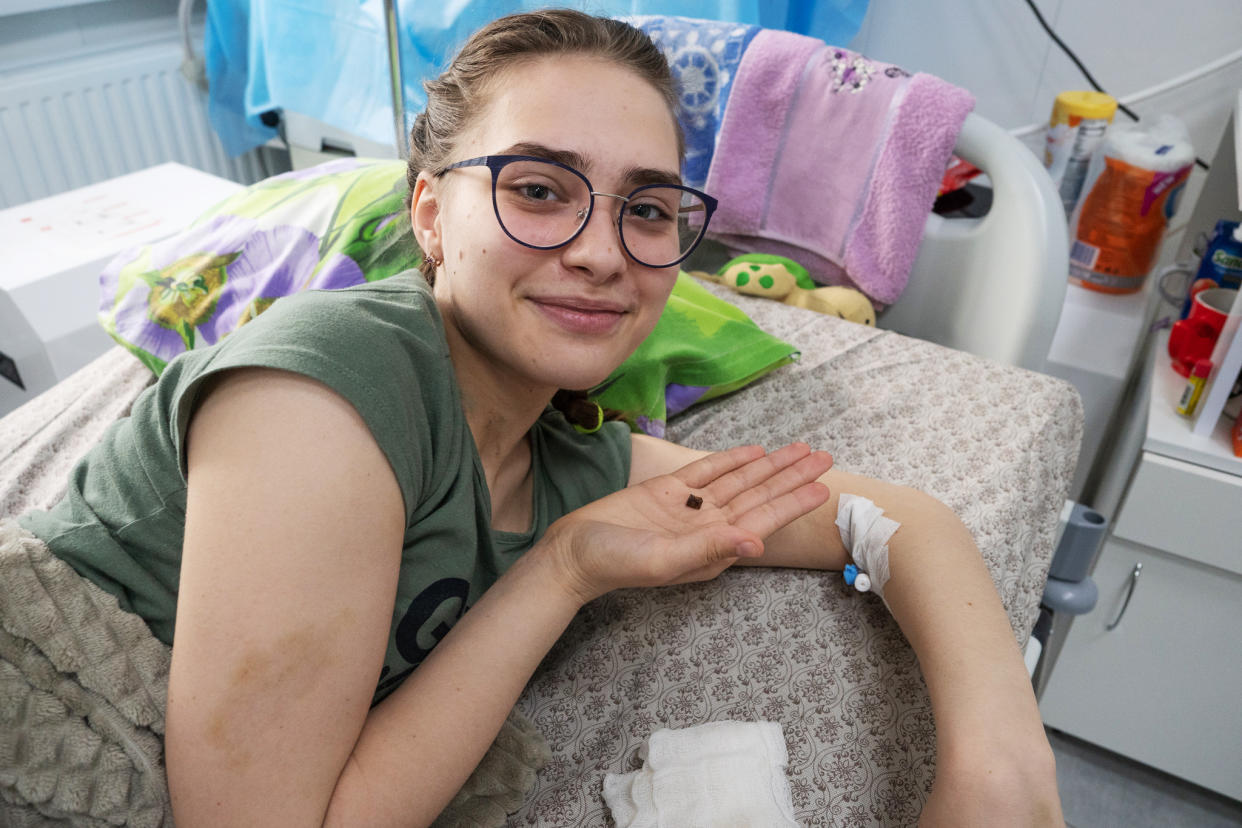 Kira Seroshtan holds a piece of metal removed from her body after she was struck by shrapnel following Russian shelling of Kharkiv. (Mo Abbas / NBC News)